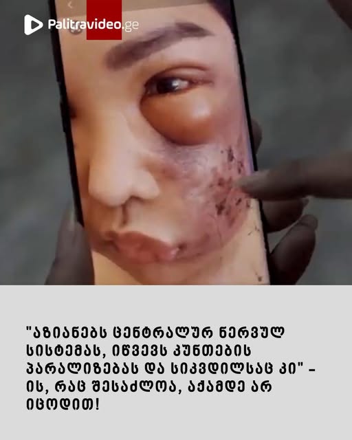 ვიდეო იხილეთ კომენტარებში