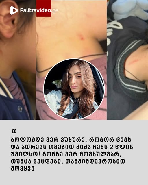 “ბოლომდე ვერ ვუყურე, როგორ ცემს და ათრევს თმებით ძიძა ჩემს 2 წლის შვილსო! გონზე ვერ მოვსულვარ, თუმცა ვეცდები, თანმიმდევრობით მოვყვე” – მოქალაქე ლიკა მახარაშვილი სკანდალურ ინფორმაციას ავრცელებს
